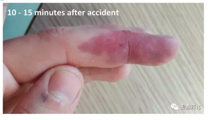 1594173411949664.png image.png